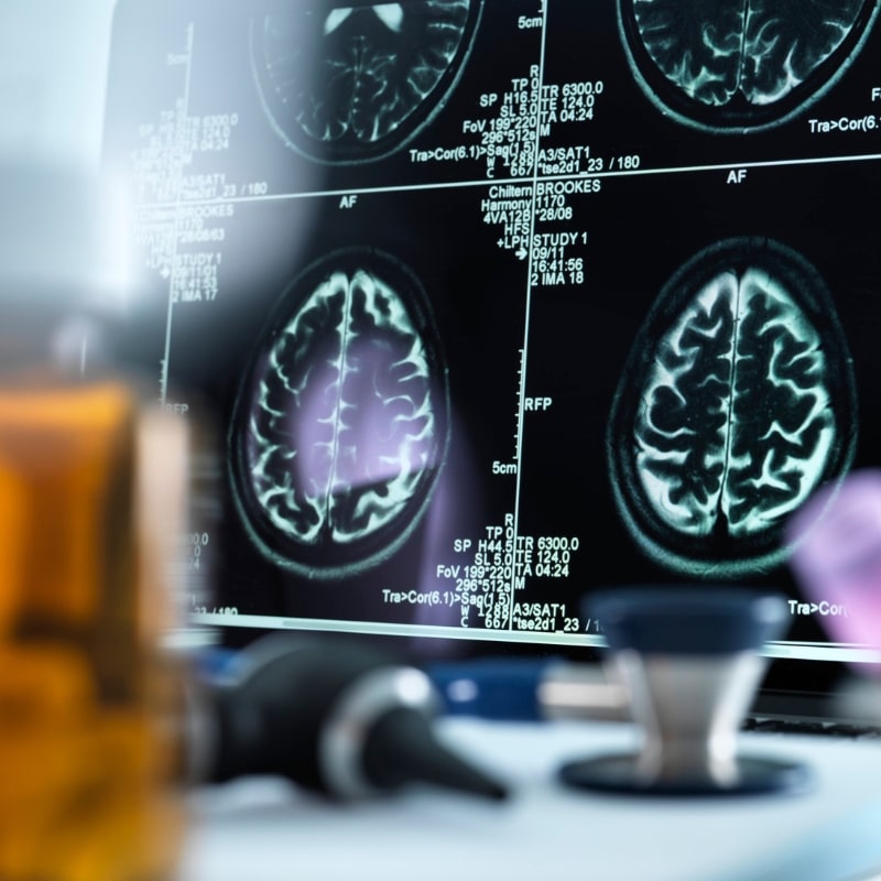 Magstim TMS for depression