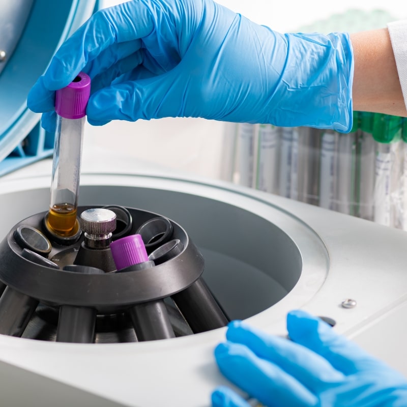 prp treatment centrifuge at zeam